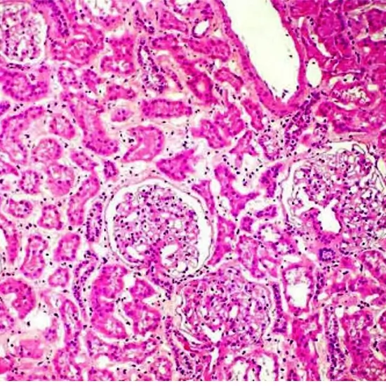 histopathology kidney biopsy panel 3 test